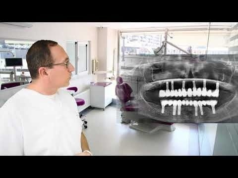 Treatment planning in our clinic accompanied by a panoramic X-ray image
